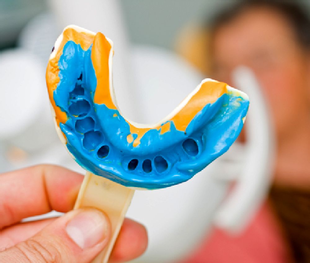 Taking DENTAL IMPRESSIONS Correction Impression Directorio Odontológico