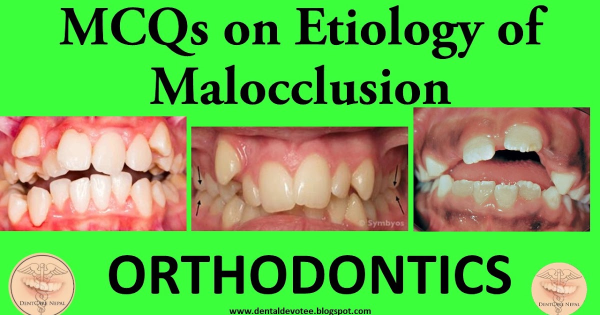 Dentosphere World of Dentistry MCQs on Etiology of Malocclusion
