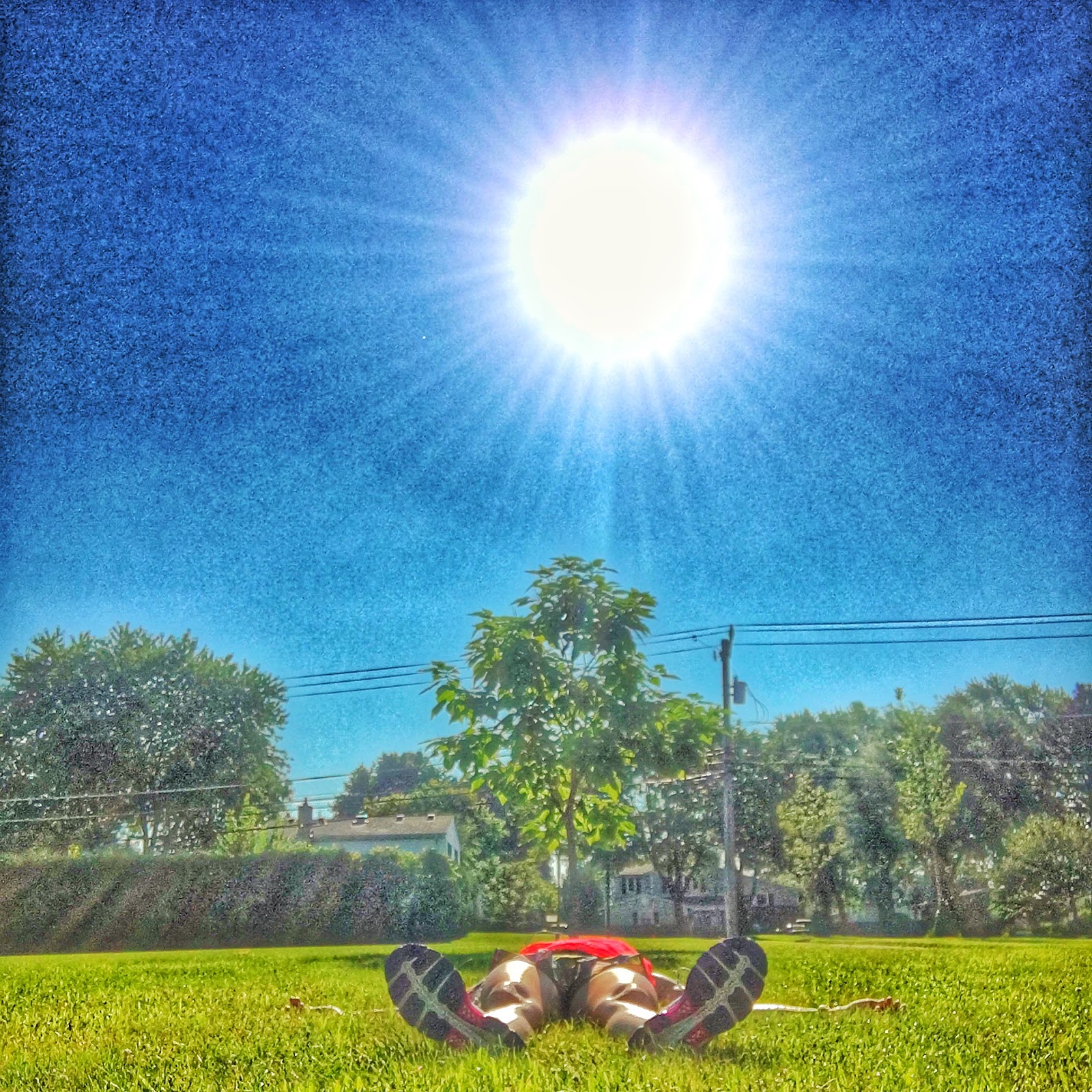 This is not a picture of heat rash. It could have been, though.