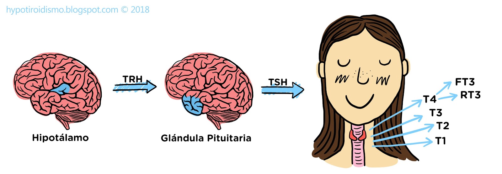 Pastillas para adelgazar con hipotiroidismo subclinico tratamiento
