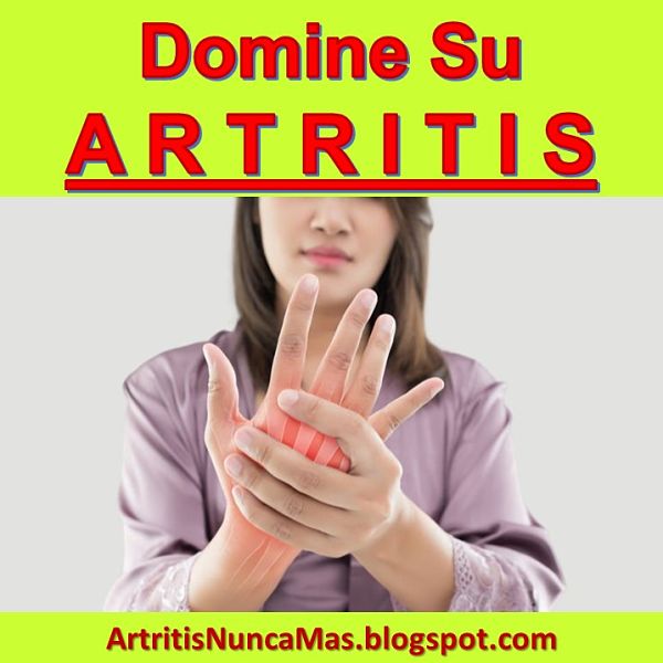 ejercicios-para-la-artritis-reumatoide-en-las-manos-osteoartritis-degenerativa