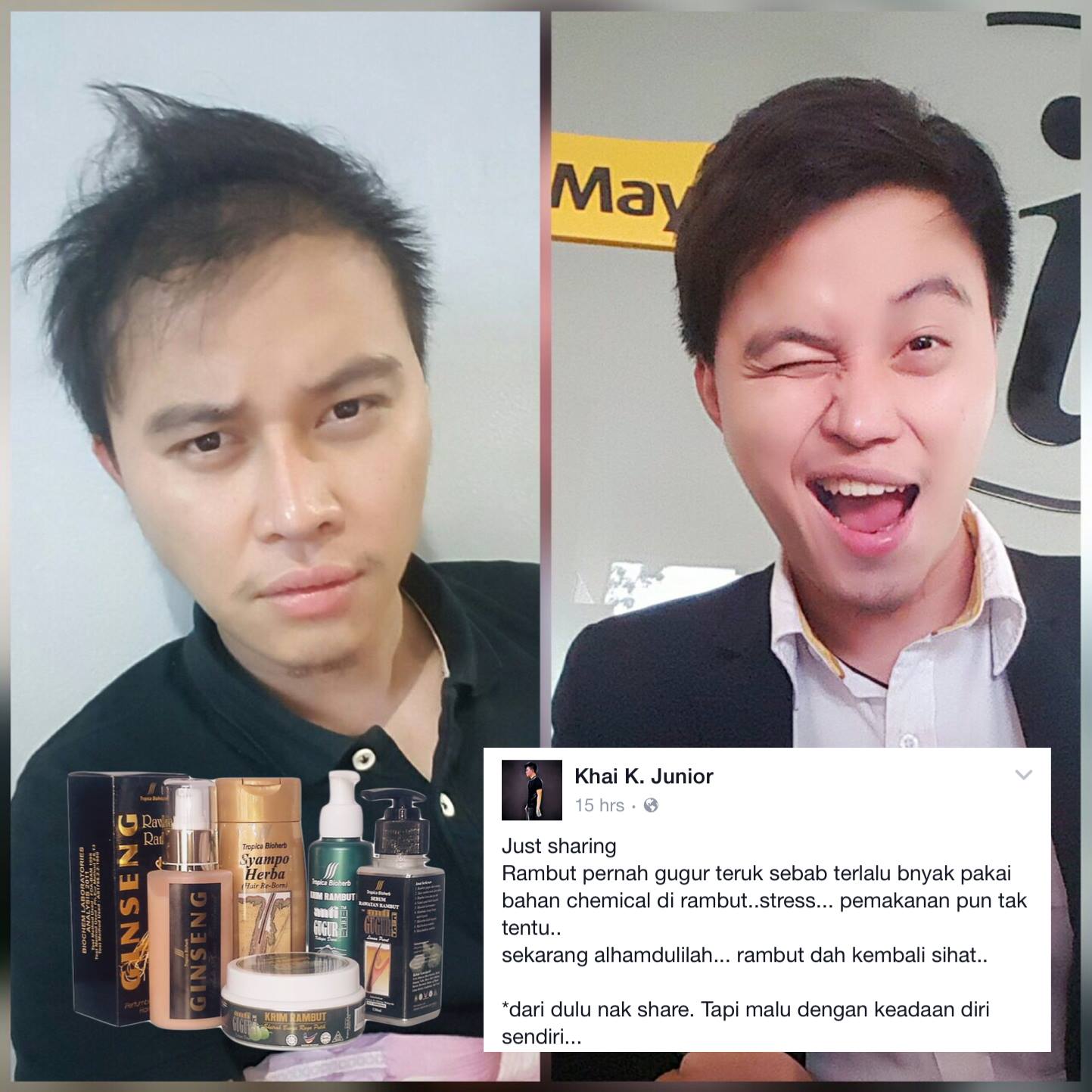Selepas 2 Bulan Rambut Yang Rosak Rapuh Dan Kebotakan Sudah Sihat Subur Kuat