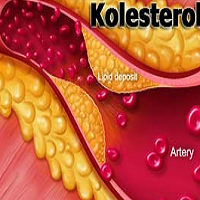 6 Ramuan Herbal Atasi Kolesterol Tinggi Dengan Bahan Alami di Sekitar Kita 6 Ramuan Herbal Atasi Kolesterol Tinggi Dengan Bahan Alami di Sekitar Kita