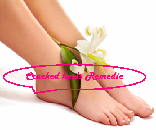  5 Natural Cracked Heels Remedie