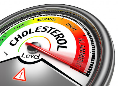 cholesterol Cholesterol level kam karne ke tips aur tarike. How to Control High Cholesterol , Tips in Hindi/Urdu.