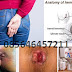 Obat Oles (salwa) Benjolan Wasir thumbnail