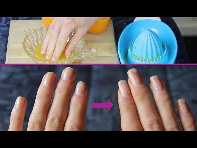 Olive oil promotes nail health
