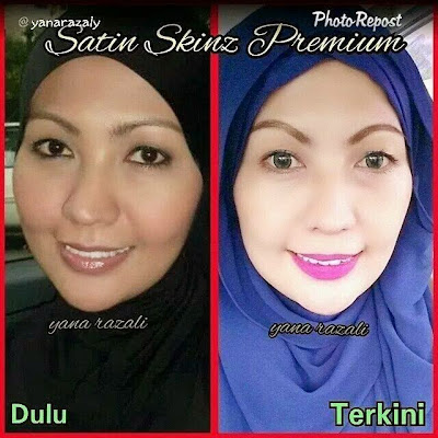 TESTIMONI SATIN SKINZ RAMAI YANG BERPUAS HATI DENGAN KEBERKESAN SATIN SKINZ, TERBUKTI BERKESAN