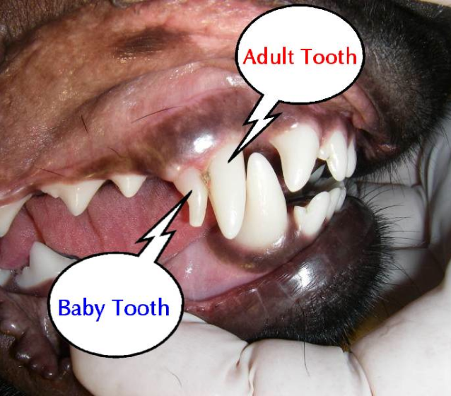 Adult Teeth Falling Out 27