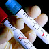 New HIV testing, treatment begins in Benue and other endemic states