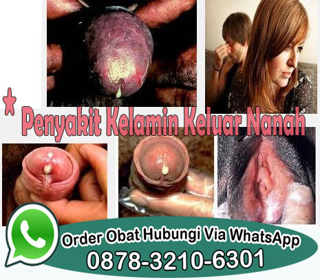 Cara Tradisional Untuk Mengobati Kencing Nanah Cara Tradisional Untuk Mengobati Kencing Nanah
