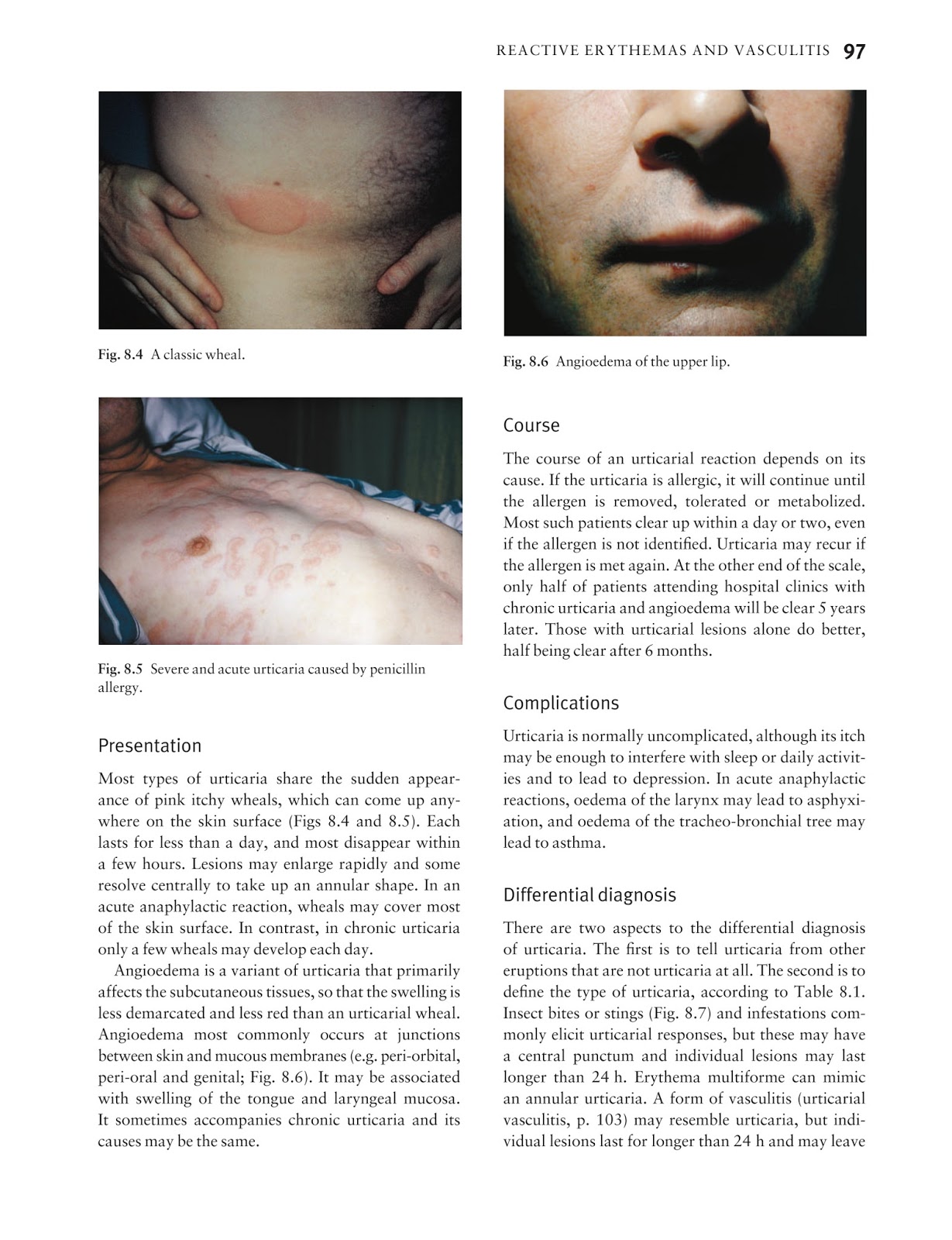 Medicine by Sfakianakis G. Alexandros Skin disease in