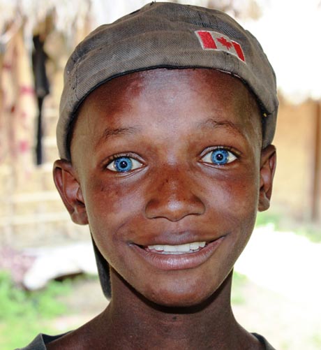 The Fascinating Phenomenon of Black People with Blue Eyes 