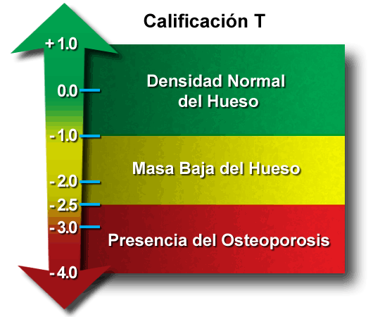 introducci-n-a-la-radiolog-a-fundamentos-de-densitometr-a-sea