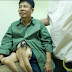 10 Orang Dengan Kelainan bentuk Mengejutkan dan Extreme