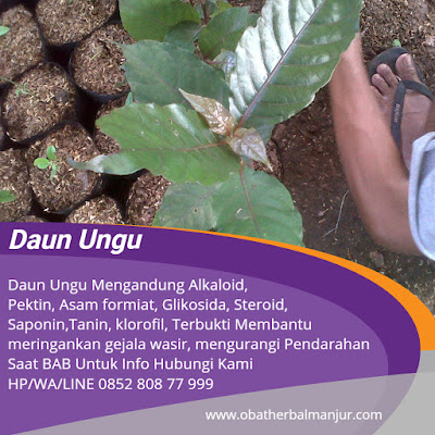 Cara Mengobati Ambeien Saat Hamil Muda Cara Mengobati Ambeien Saat Hamil Muda