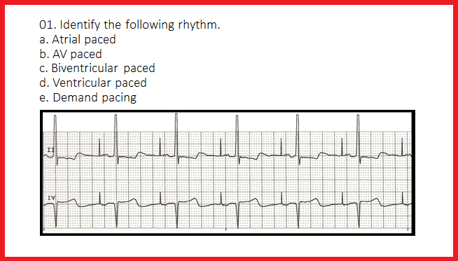 pacemaker av sequential pacemaker av sequential