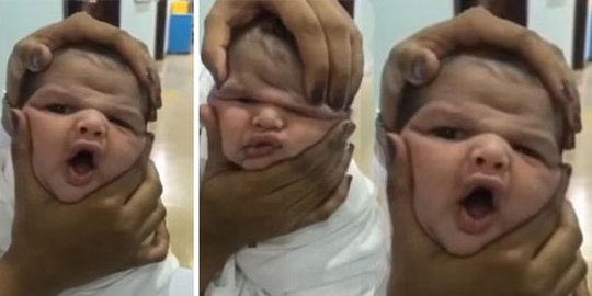 Viral Aksi Suster Mainkan Wajah Bayi, Perhatikan Cara ini Sebelum Memilih Rumah Sakit