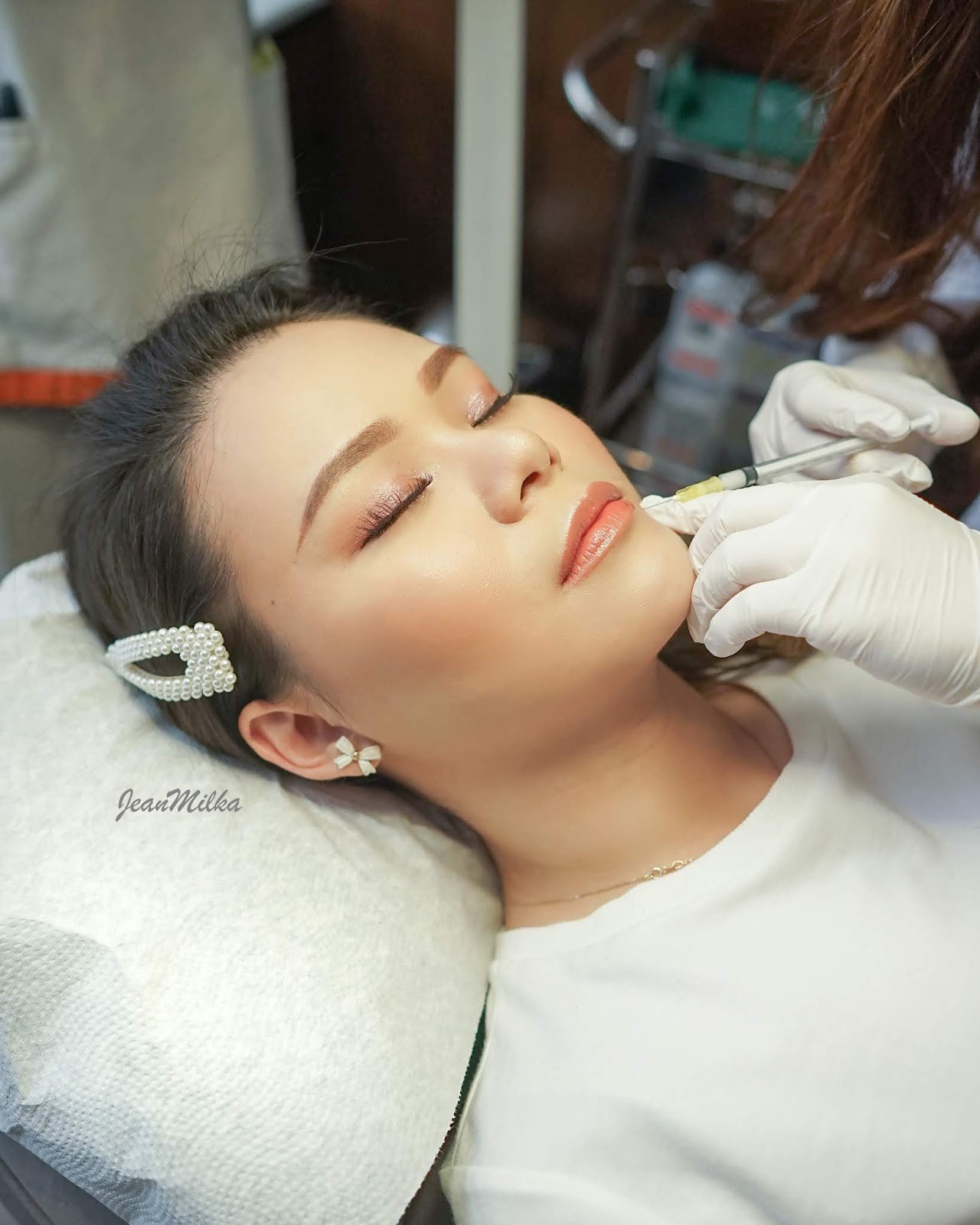 Pengalaman Treatment Jerawat Dan Bekas Jerawat Di Erha Derma Center Jean Milka