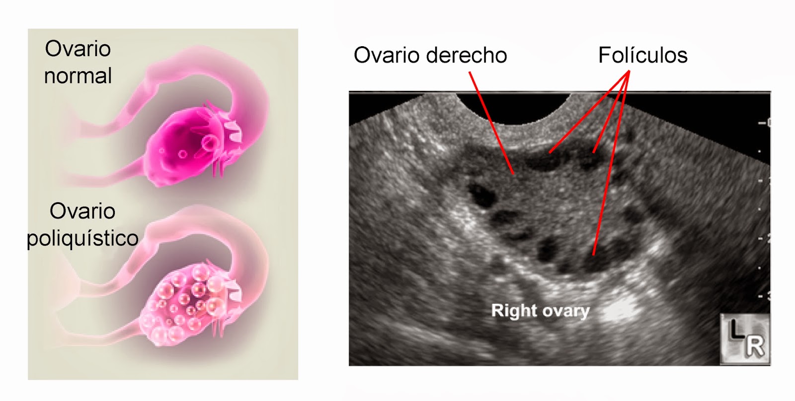 Funcionamiento ovarios
