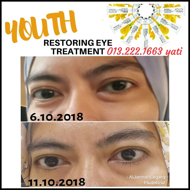 Testimoni-Youth-Eye-Treatment-Shaklee