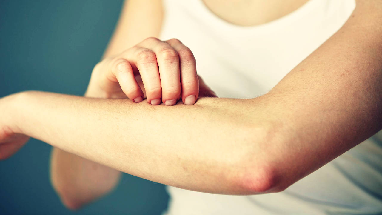 Gambar Obat Tradisional Kurap Alami