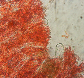 Microstoma protractum red pigment paraphyses
