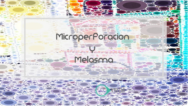 Microperforacion y melasma 