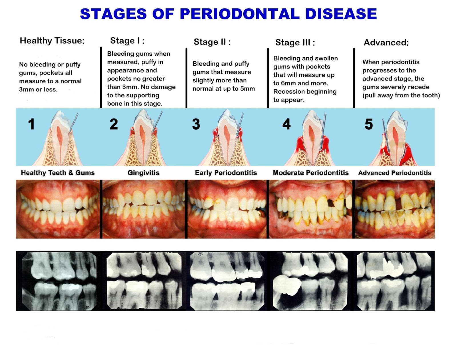 Walnut Creek Cosmetic Dentist Dr. Daniel R. Pestana DDS, APC: Stages of