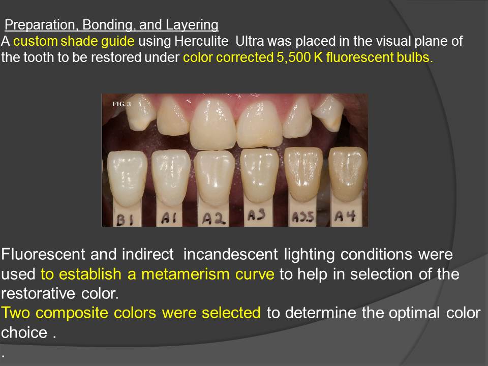 DOs and DONTs in DENTISTRY HOW TO SELECT THE CORRECT SHADE OF