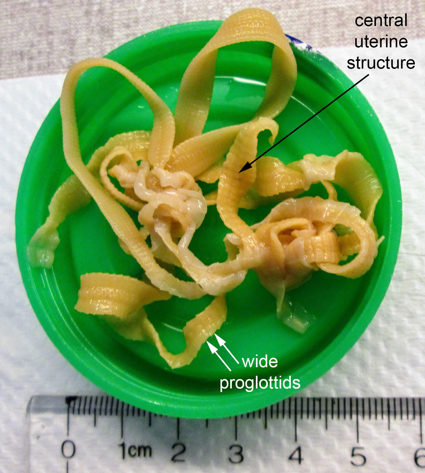 Creepy Dreadful Wonderful Parasites Answer to Case 454