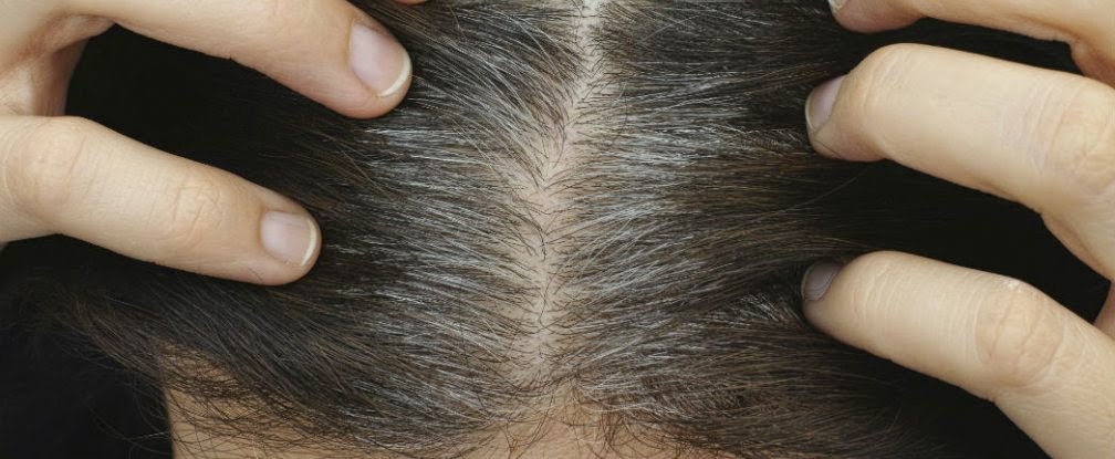 salen canas en el pelo pubico