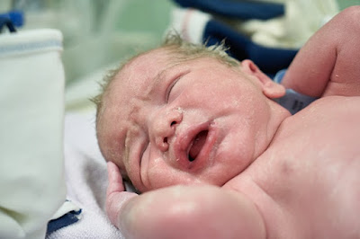 Kenali gejala alergi pada bayi karena penggunaan deterjen Kenali gejala alergi pada bayi karena penggunaan deterjen