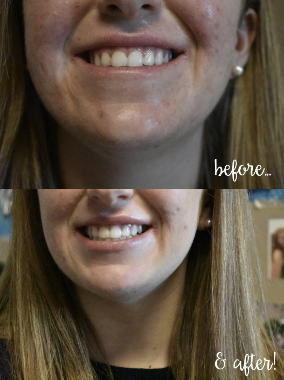 Smile brilliant coupon code