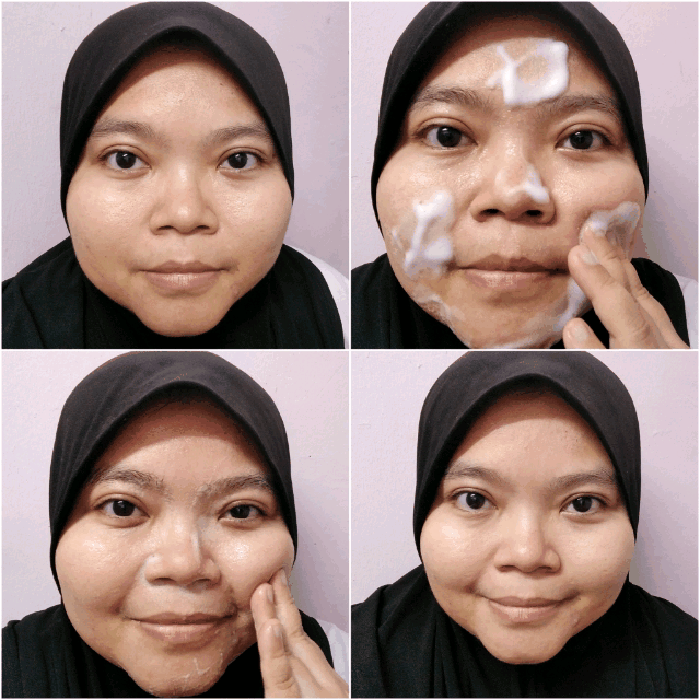 Muka Lebih Lembap dan Bersih Selepas Menggunakan ALOE AC Clean Bubble Cleanser Muka Lebih Lembap dan Bersih Selepas Menggunakan ALOE AC Clean Bubble Cleanser