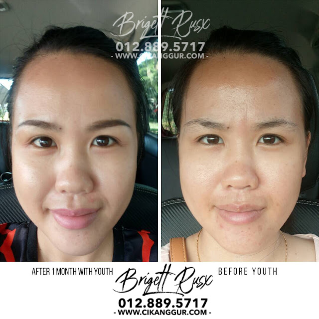 rahsia-hilangkan-kulit-kusam-secara-semulajadi-dan-cepat rahsia-hilangkan-kulit-kusam-secara-semulajadi-dan-cepat