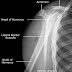 11+ Anatomi Pedis X Ray