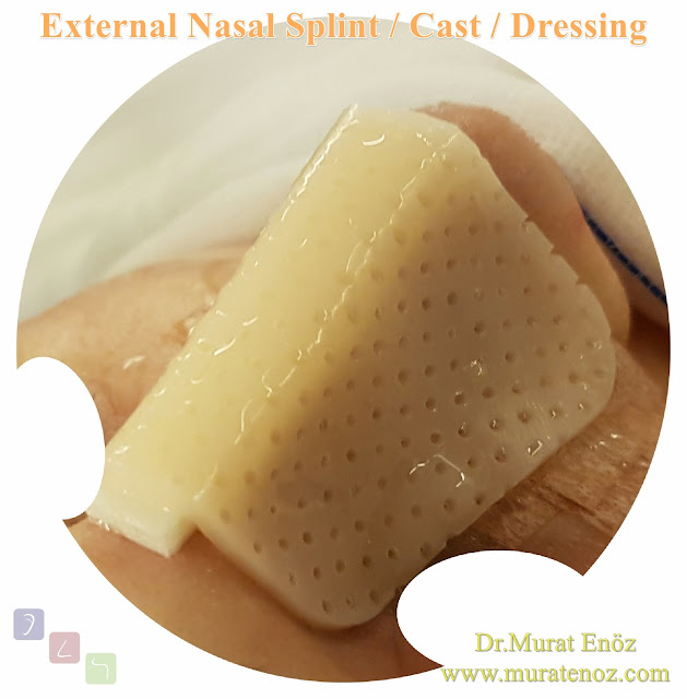 External Nasal Splint / Cast / Dressing