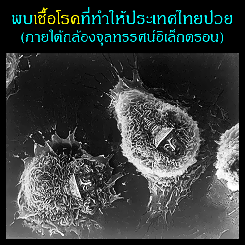พบเชื้อโรคที่ทำให้ประเทศไทยป่วย (ภายใต้กล้องจุลทรรศน์อิเล็กตรอน)
