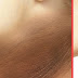 Home remedies to get white complexion of neck