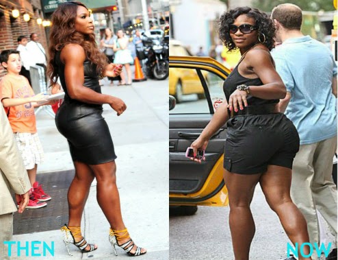 [Image: Serena%2BWilliams%2BCosmetic%2BSurgery-butt.jpg]