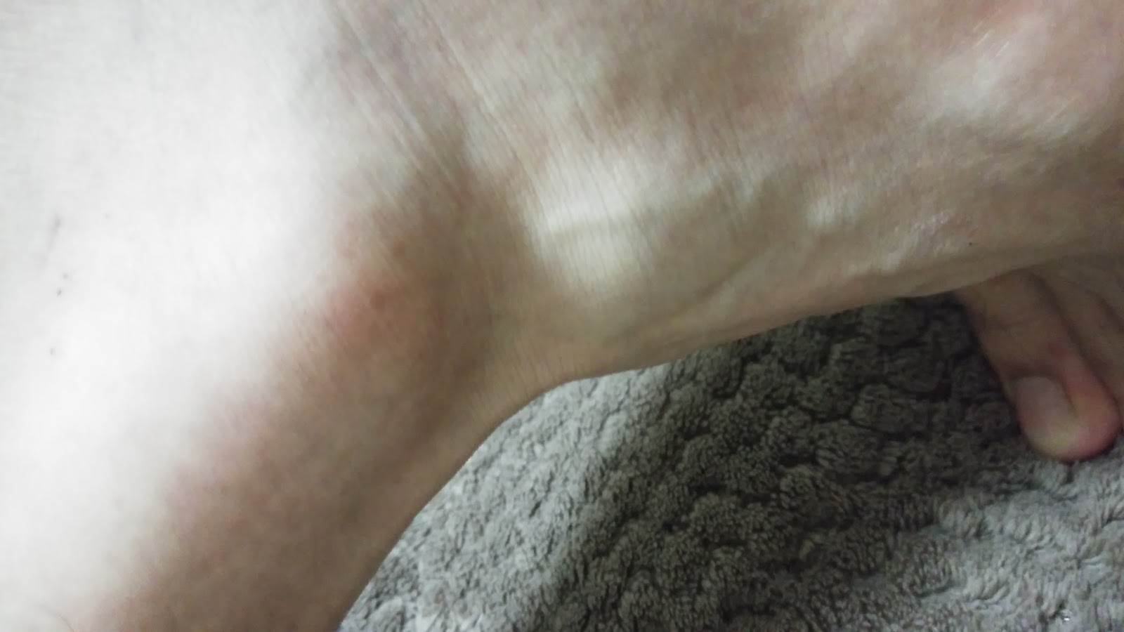 First World Becker Muscular Dystrophy Cure Project by WMDROC [Terminated]