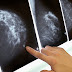 Dutch Scientists Just Obliterated Breast Cancer Tumors in Under 11 Days WITHOUT Chemo