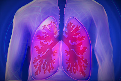 Streptococcus pneumoniae