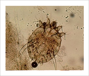 eukarióta sejtparaziták paraziták a bőr kezelésén