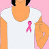 Breast Cancer - Stages, Symptoms, Causes, Diagnosis and Methods of Treatment