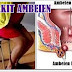 obat sakti herbal ambeien stadium 3 thumbnail