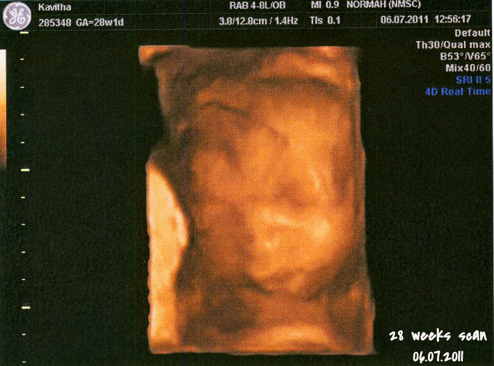 Ruthies's Journal 28 Weeks 2D & 3D/4D Ultrasound Scan Photos