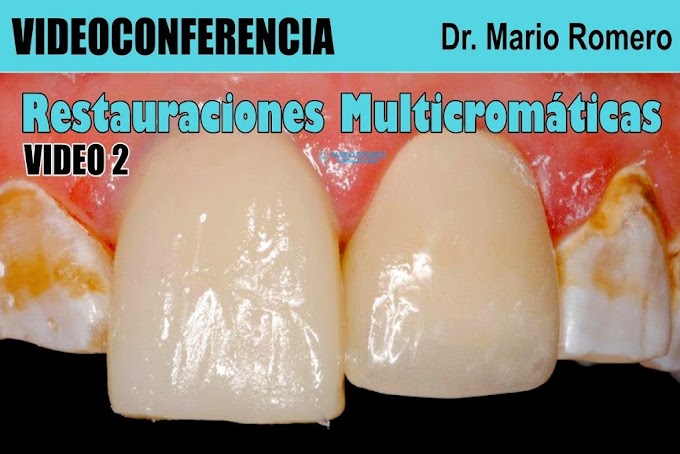 VIDEOCONFERENCIA: Restauraciones Multicromáticas (Video 2) - Dr. Mario Romero