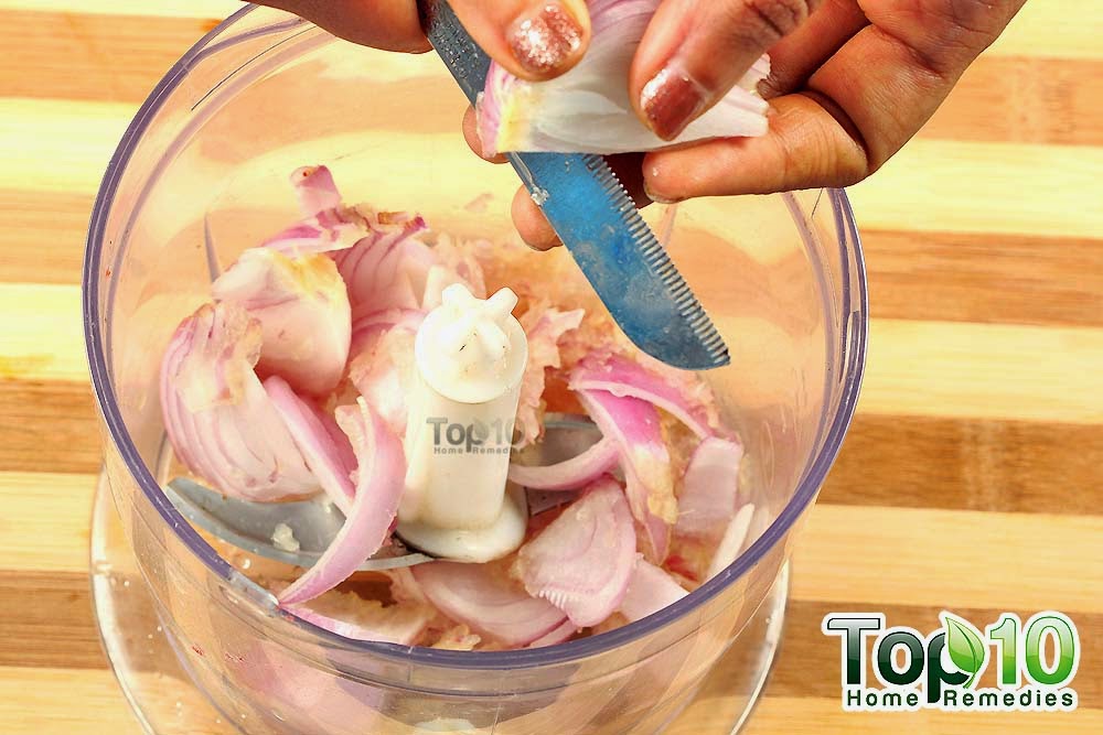 100 Natural Hair Loss Treatment Home Remedy Style Hunt World